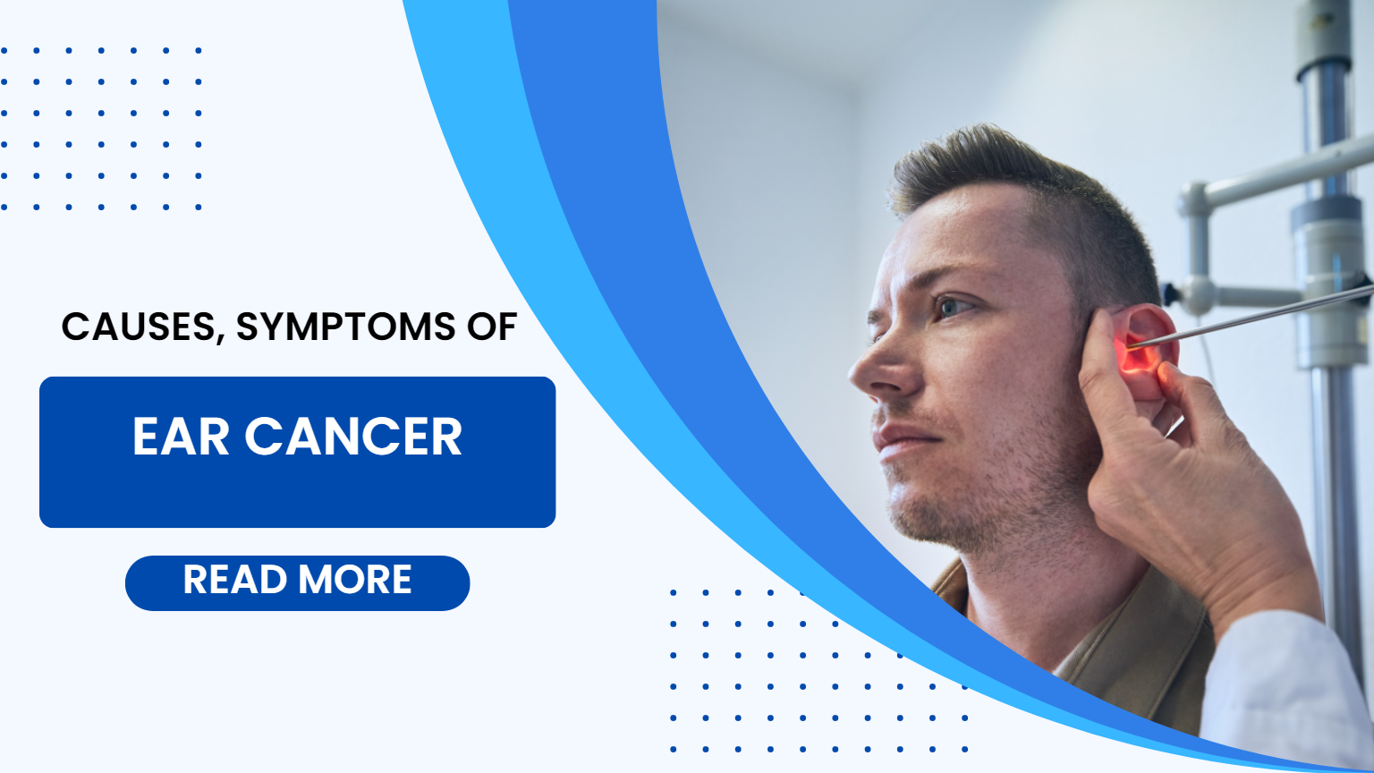 what-are-the-most-common-causes-and-symptoms-of-ear-cancer-ent-and